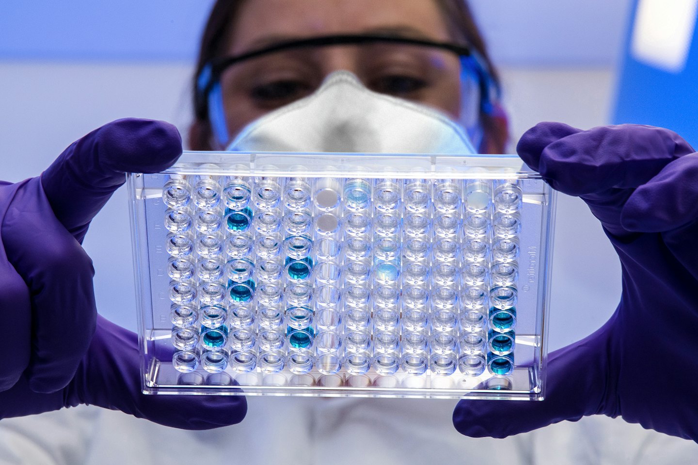 Técnico de laboratorio examina placa de pocillos con muestras líquidas coloridas.