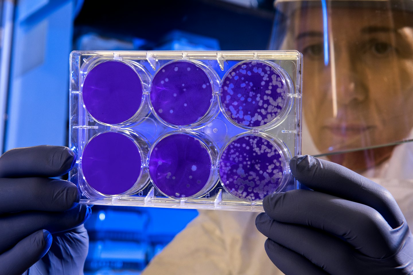 Científico con bata de laboratorio examina placa de pocillos con crecimiento bacteriano.